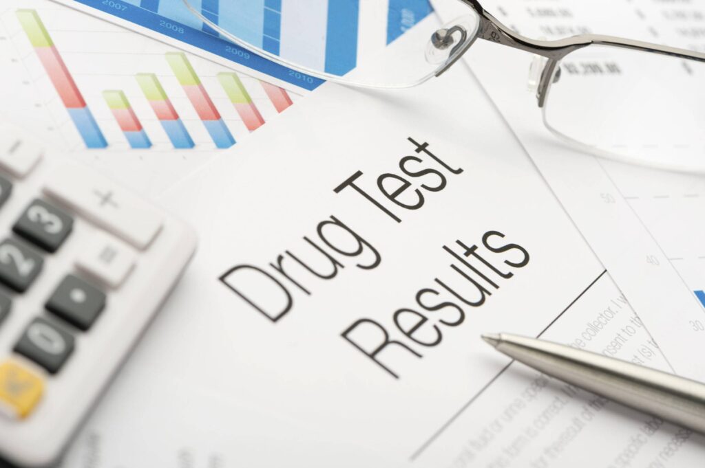 Pros & Cons of Workplace Drug Testing - PrideStaff
